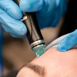 Hydrafacial,With,Blurred,Foreground,And,Background